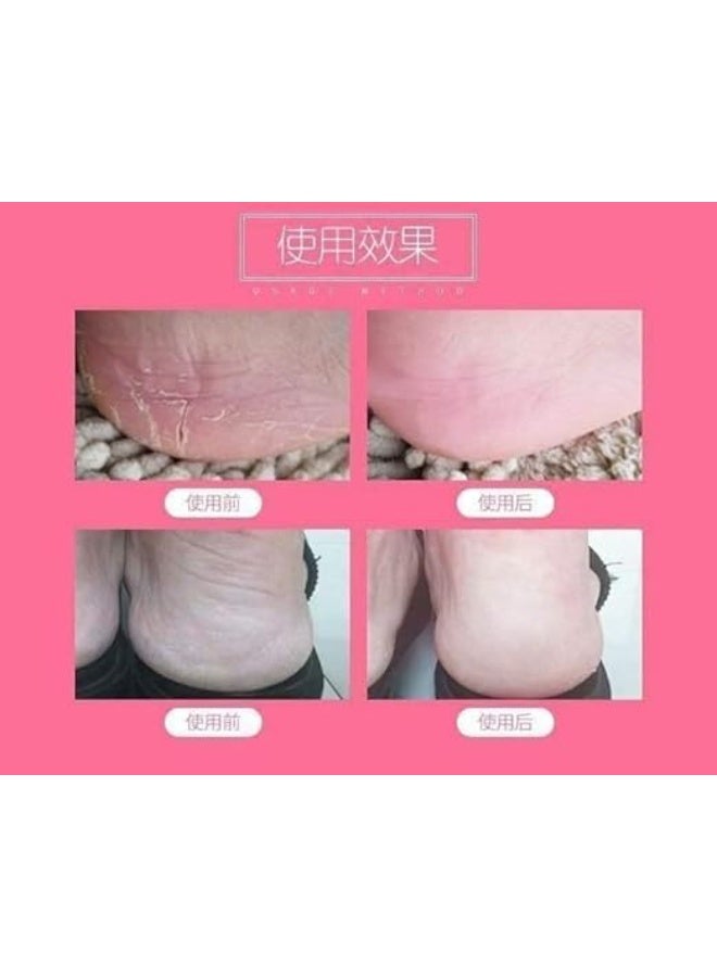 Medical silicone socks – the ideal solution for cracked heels DH - Image 3